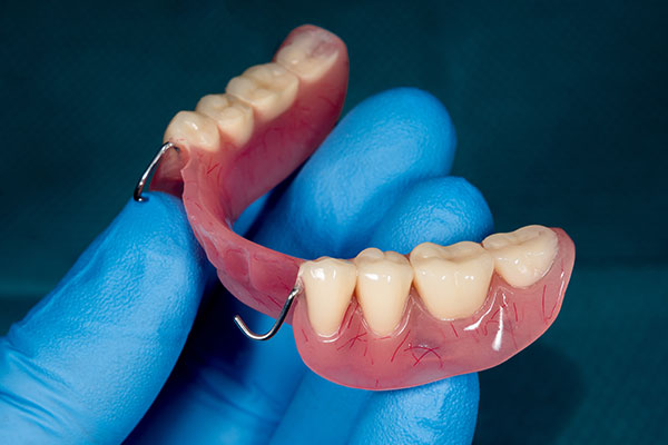 dentist holding partial denture
